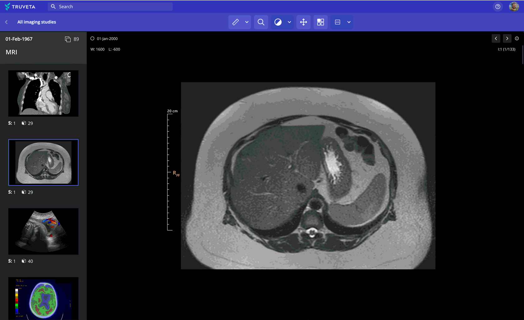 Truveta now empowers researchers to learn from millions of de-identified medical images – across all modalities, including MRI, CT, X-ray, ultrasound, mammogram, PET, and nuclear medicine – integrated with the patient’s EHR data to more deeply understand symptoms, diagnoses, disease progression, and more.