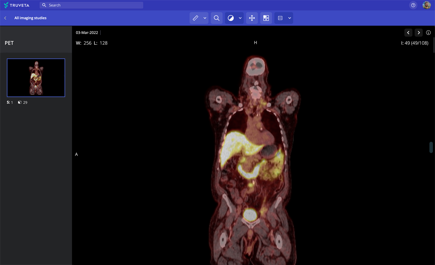 PET oncology research RWD RWE cancer imaging full patient journey cancer screening