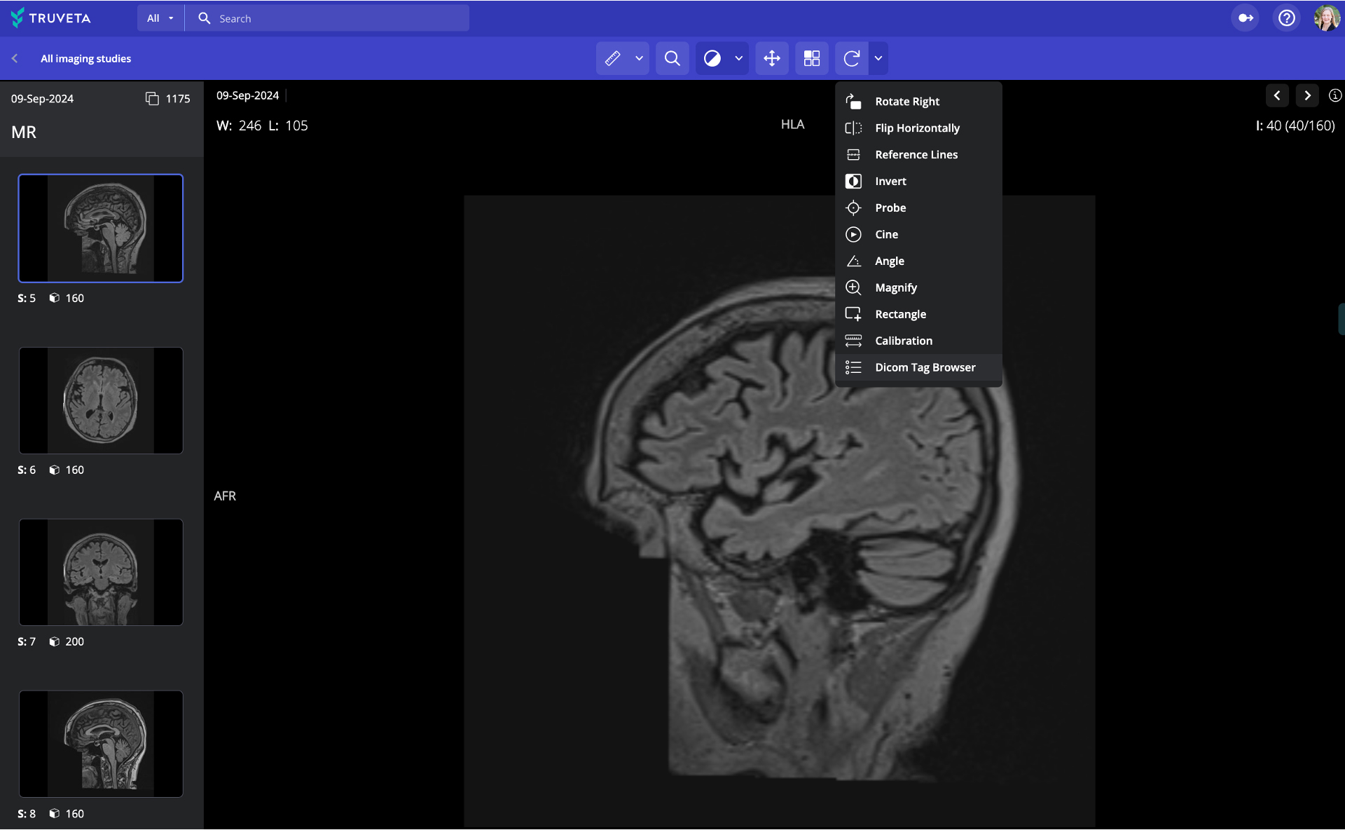 Imaging-Studies Linked imaging and blood-based biomarker data — including hundreds of thousands of brain imaging studies for patients with dementia (such as MRI, PET, and other scan types), along with lab results for p-tau181, p-tau217, Aβ40, Aβ42, and Aβ42/Aβ40 ratios.