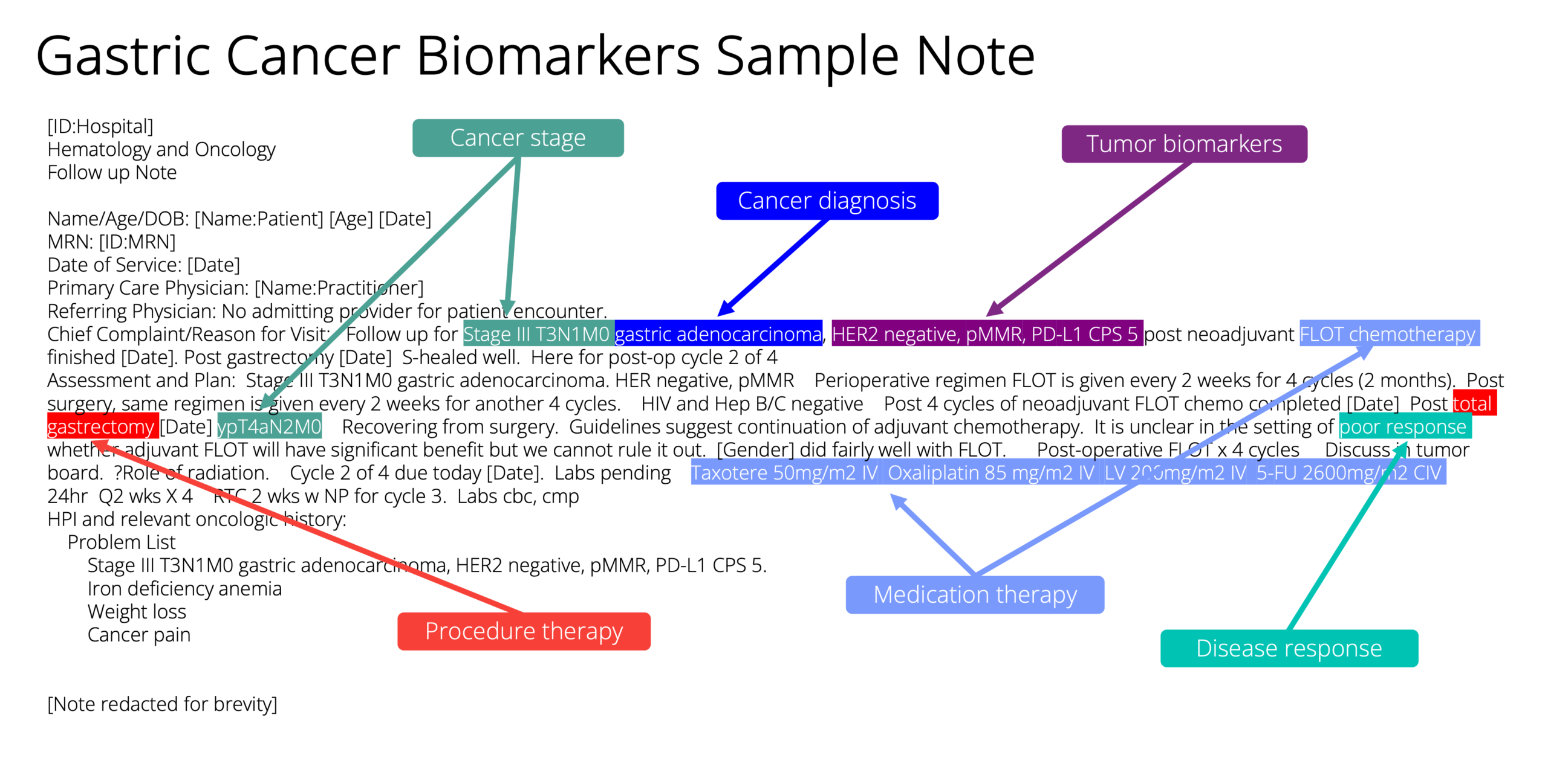 sample epilepsy patient note